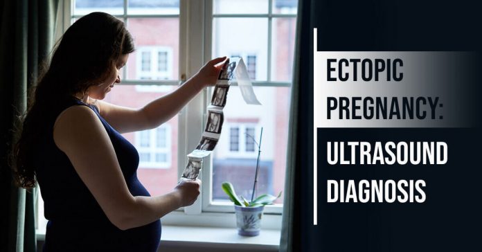 Ectopic Pregnancy Ultrasound Diagnosis Cover