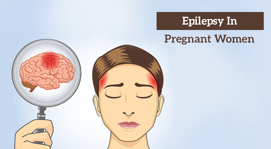 Epilepsy Pregnant Women